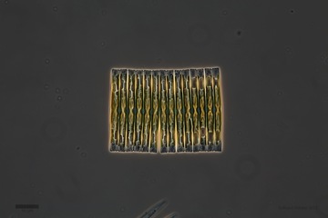 picture of diatom